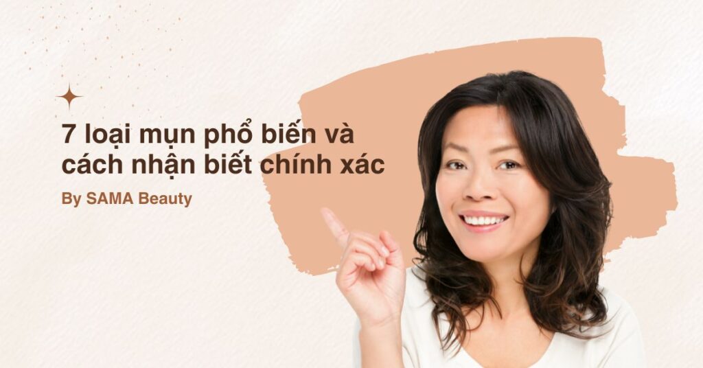 7 loại mụn phổ biến và cách nhận biết chính xác