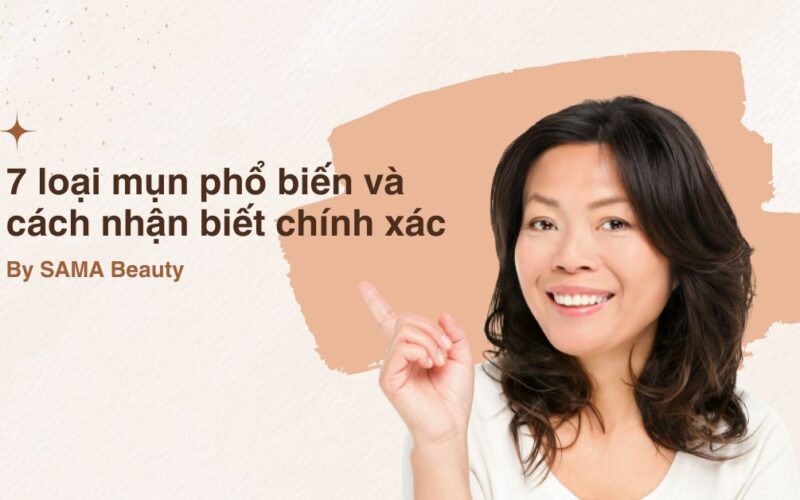 7 loại mụn phổ biến và cách nhận biết chính xác